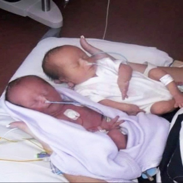 Couple expects identical twins — freeze when the doctor says “I’m sorry”